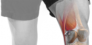 Système Atlas : nouveau dispositif pour l’arthrose modérée du genou