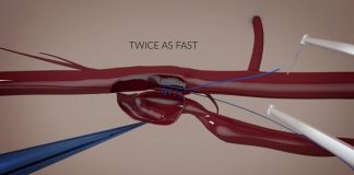 Switch : un nouvel outil de suture simple et rapide