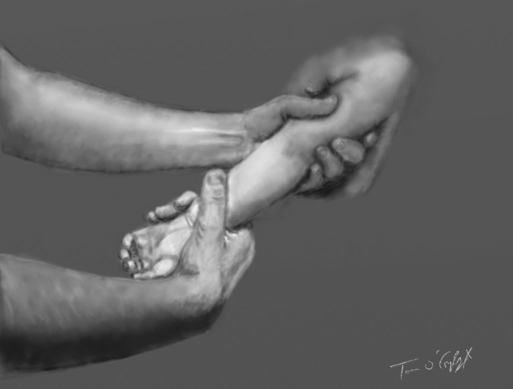 pronation douloureuse