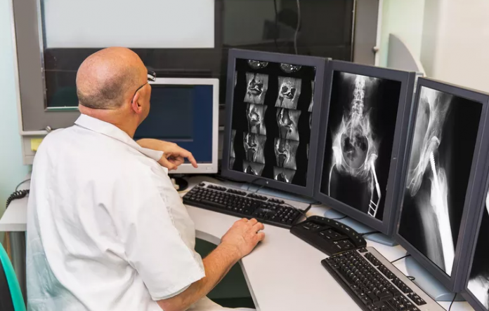 Radiologie tumeurs osseuses