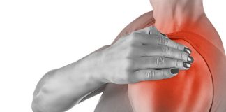 Traiter une calcification de la coiffe des rotateurs calcification de la coiffe des rotateurs