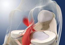 ligament croisé postérieur